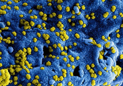 Afbeelding Informatie-update m.b.t. maatregelen coronavirus